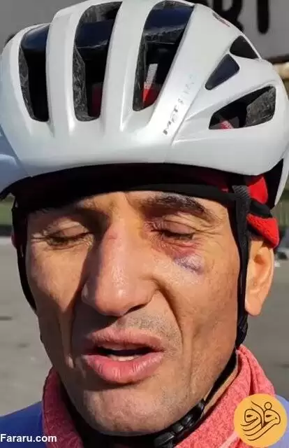(عکس) حمله با پنجه بوکس به دوچرخه سوار ایران