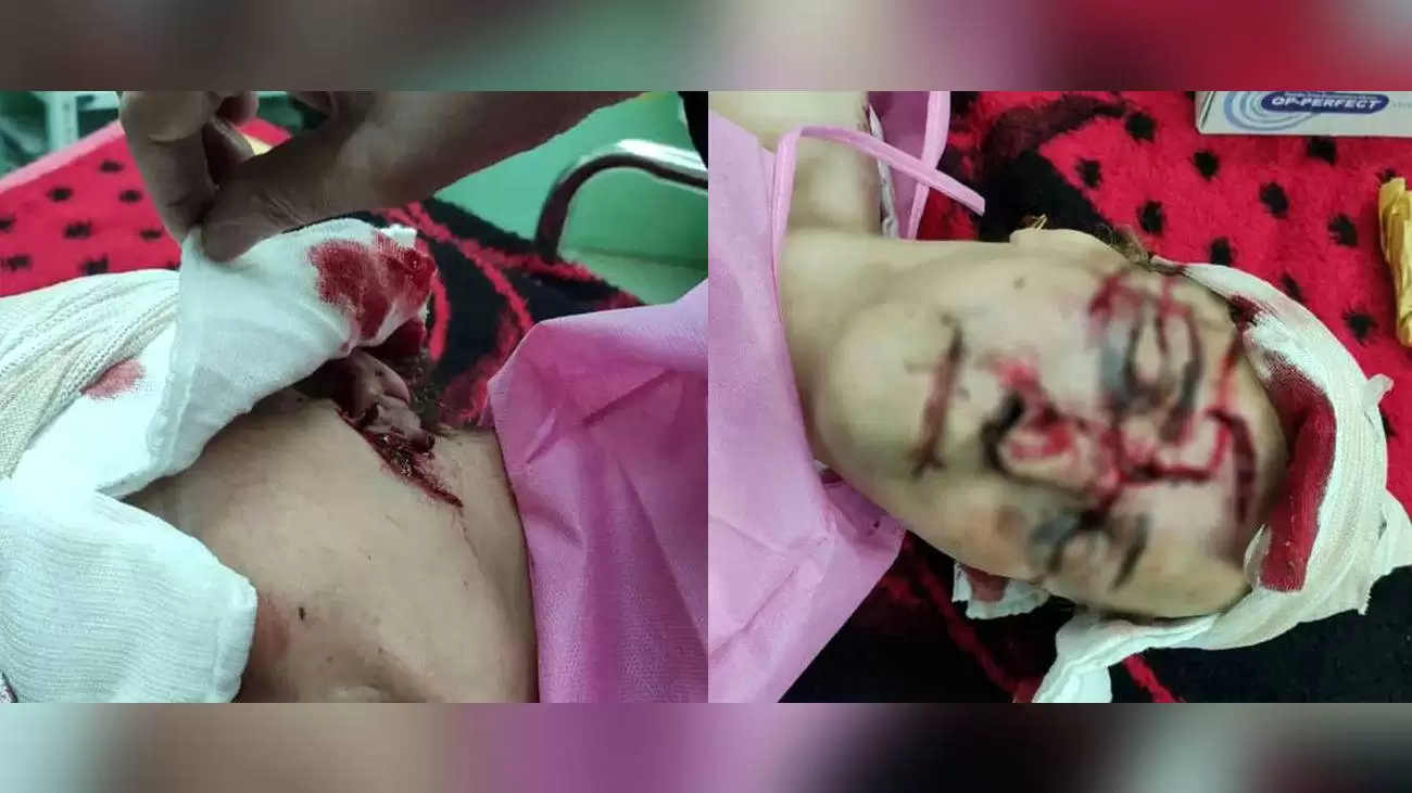 نخستین تصاویر ناگوار از زن پیرانشهری که هدف حمله خرس وحشی شد 