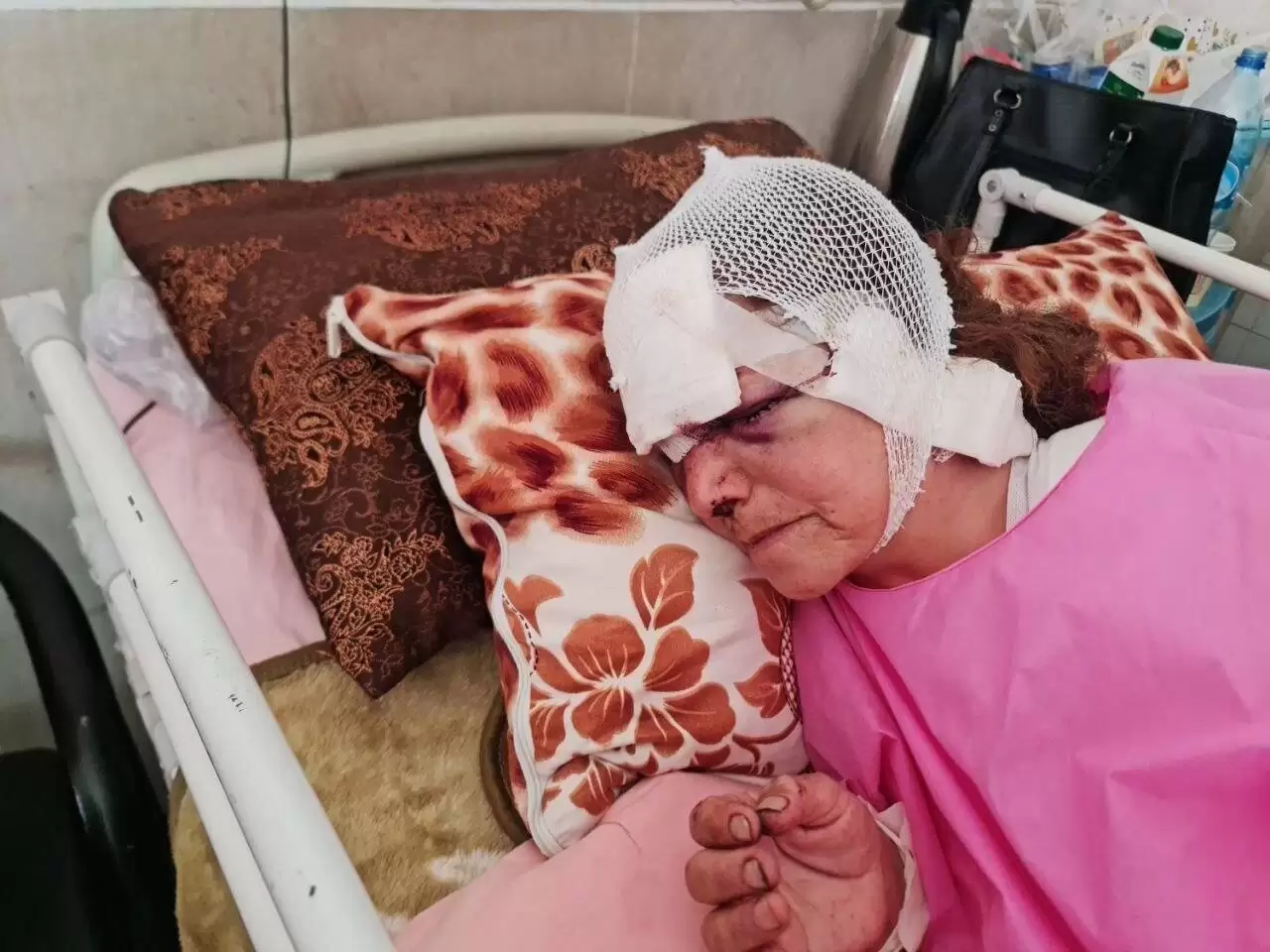 جدال زن 60 ساله و خرس در ارتفاعات پیرانشهر -  روایت ماجرا از زبان پسرش+ تصویر ناگوار زن در بیمارستان