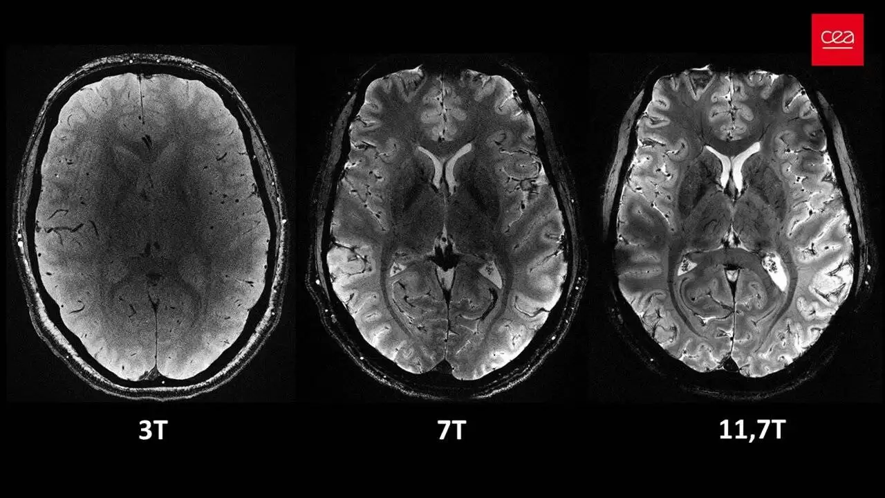 واضح ترین تصویرها از مغز با قوی ترین دستگاه ام آرآی