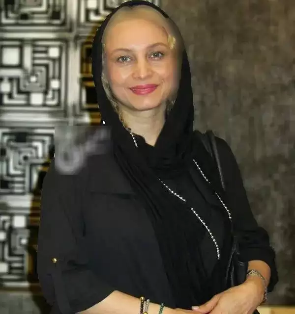 عکس غیر قابل باور و دیده نشده از چهره مریم کاویانی -  خانم بازیگر کوبیده از نو ساخته !