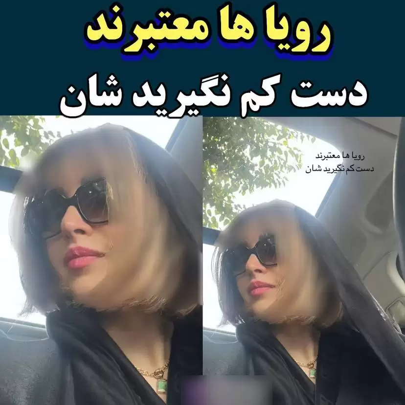 تغییر چهره جذاب بهنوش طباطبایی  -  عمل جراحی برای بار هزارم!  -  جوان تر 20 ساله ها شد!