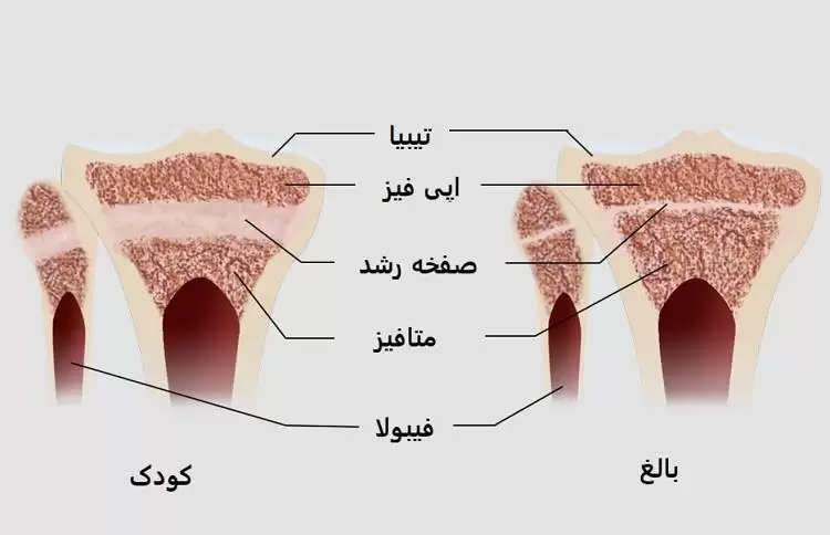 ورزش بدنسازی و کوتاهی قد؛ علم چه می گوید؟