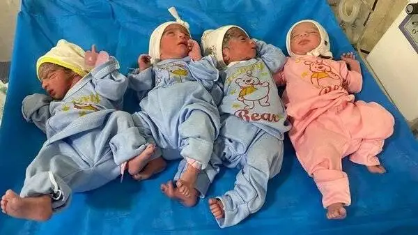 زن زاهدانی که چهار فرزند داشت، چهار قلو به دنیا آورد -  عکس