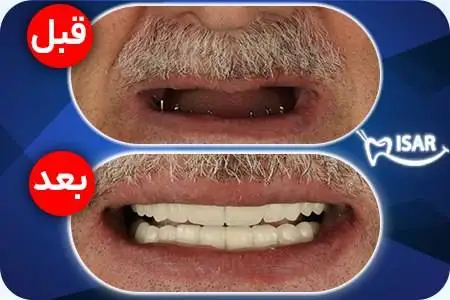 عکس - چهره جدید (حسین جعفری) بازیگر کودکی یوزارسیف در یوسف پیامبر بعد از 21 سال!