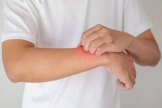 دلیل عود جوش و حساسیت های پوستی در بهار چیست؟ -  صابون زردچوبه و شیر الاغ موثر است؟ -  شوینده های آلوئه ورا و چای سبز چطور؟