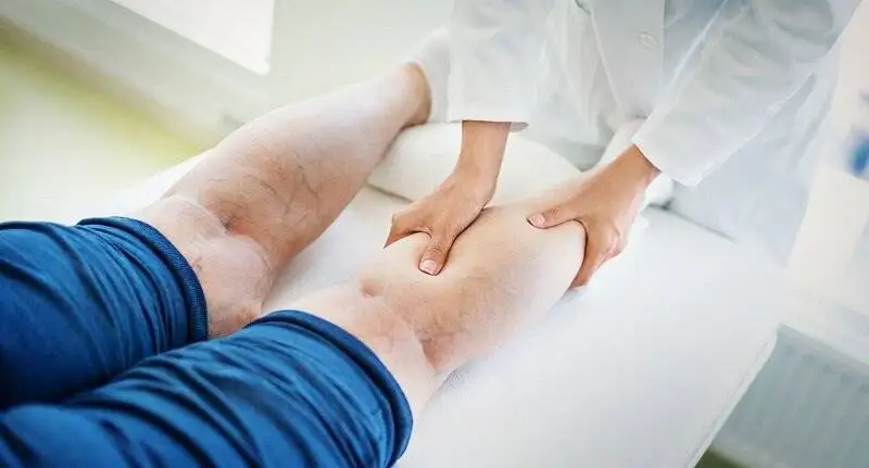 برای پیشگیری از واریس این عادت روزانه را جدی بگیرید