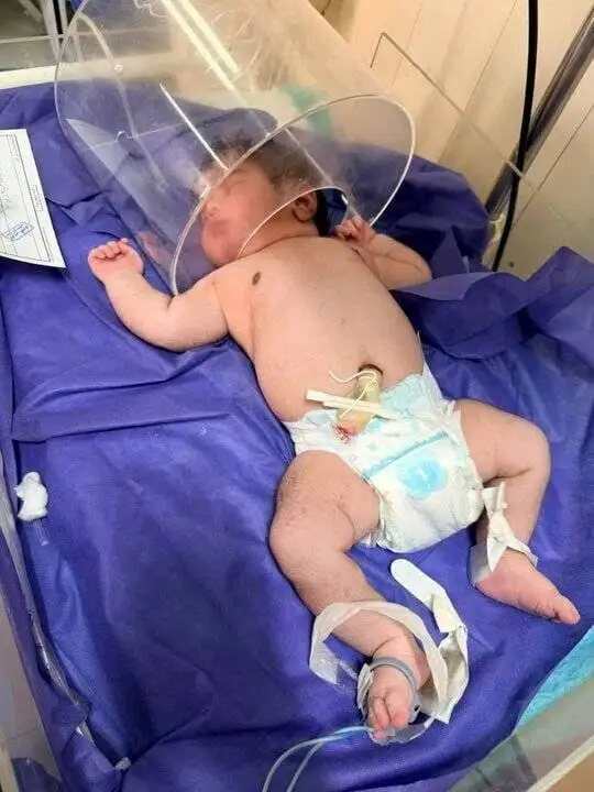 تصویر تولد کم سابقه پسر 5کیلو و 650 گرمی در کرمانشاه