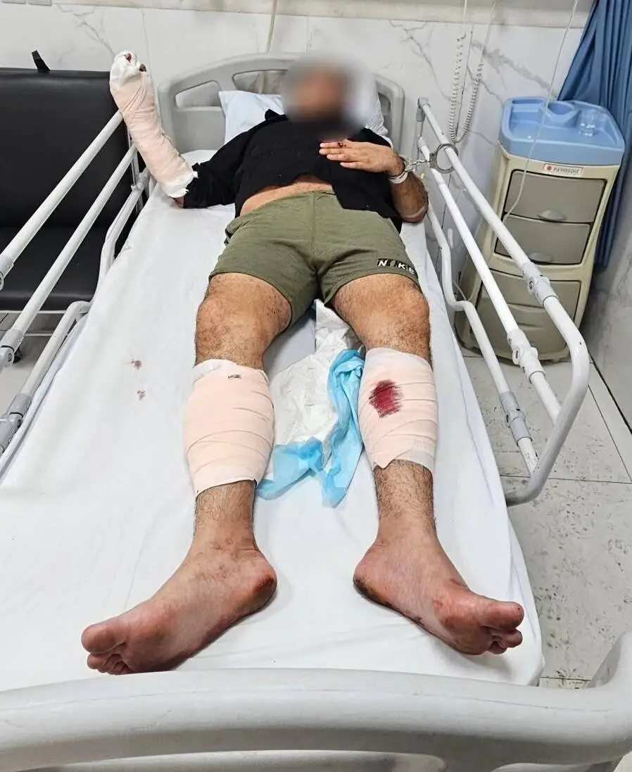 عامل ضرب وشتم زنان در ویدئوهای اینستاگرام، با شلیک پلیس زمین گیر شد - هویت (نوید) متولد 1369 شناسایی شد - عکس