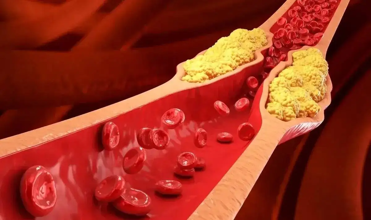 این خوراکی ها کلسترول بد را پایین می آورند؛ حجم غذا مهم تر است یا نوع آن؟