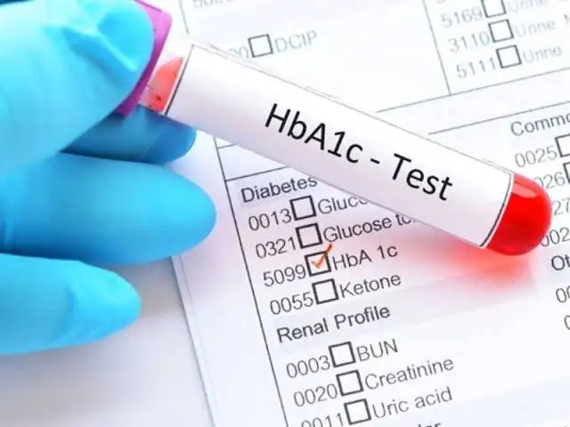 این عدد مهم در آزمایش خون، قند 3 ماه گذشته تان را لو می دهد - hba1c چیست و چرا بالا می رود؟