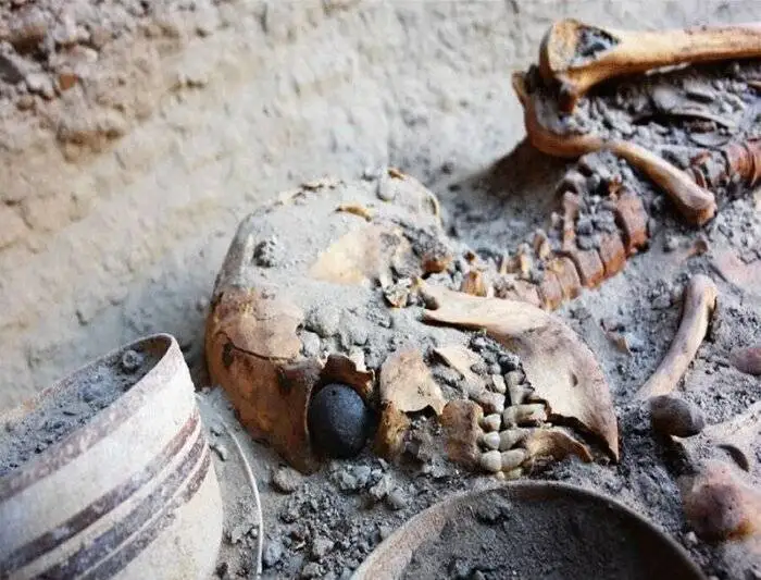 شهر سوخته؛ تمدنی که 5 هزار سال جلوتر از زمان خود بود -  رازهای تمام شهر؛ از پروتز چشم تا جراحی مغز