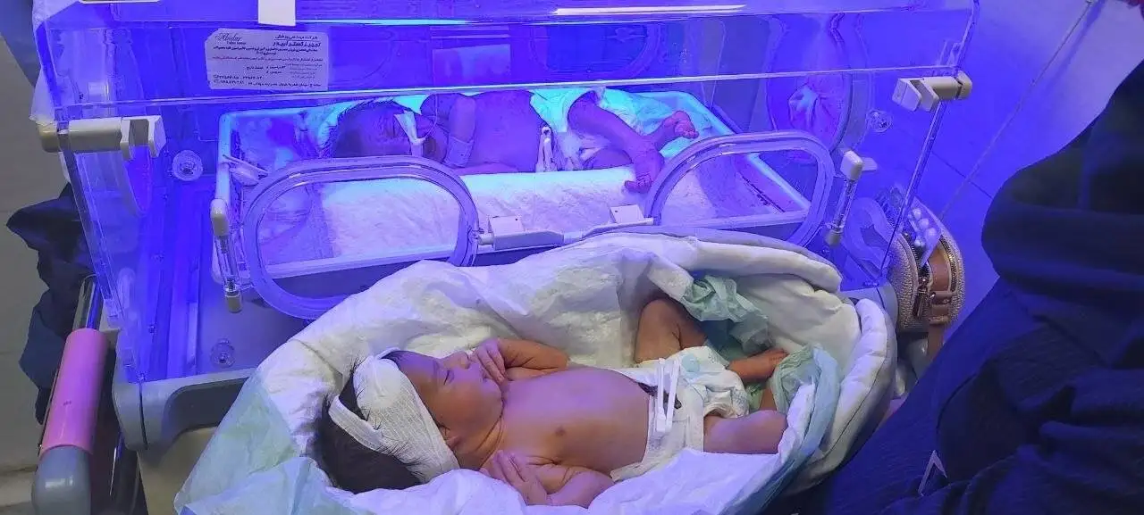 اتفاق جالب و شیرین در سنندج؛ تولد 15 نوزاد از 6 زایمان در یک روز