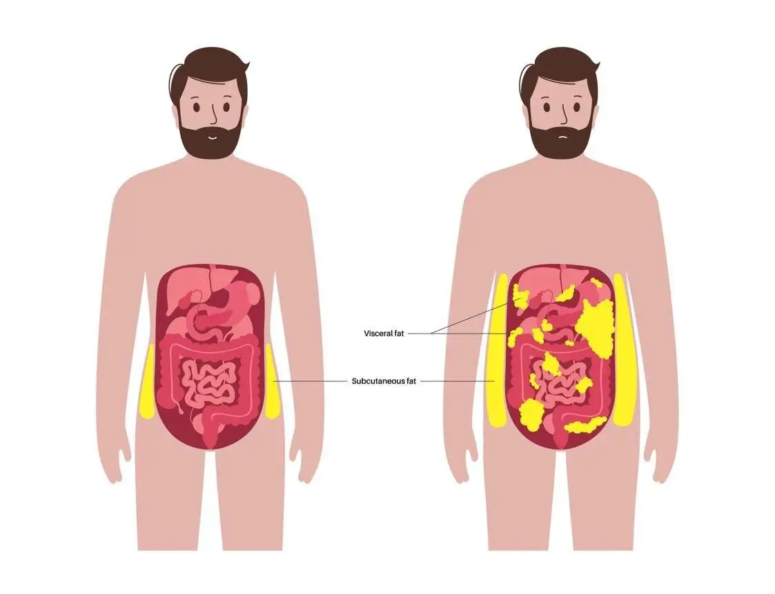 اگر شکم تان بزرگ تر شده، قلب تان هم در خطر است؟ ؛ راز تازه سلامت قلب در اندازه دور کمر شماست