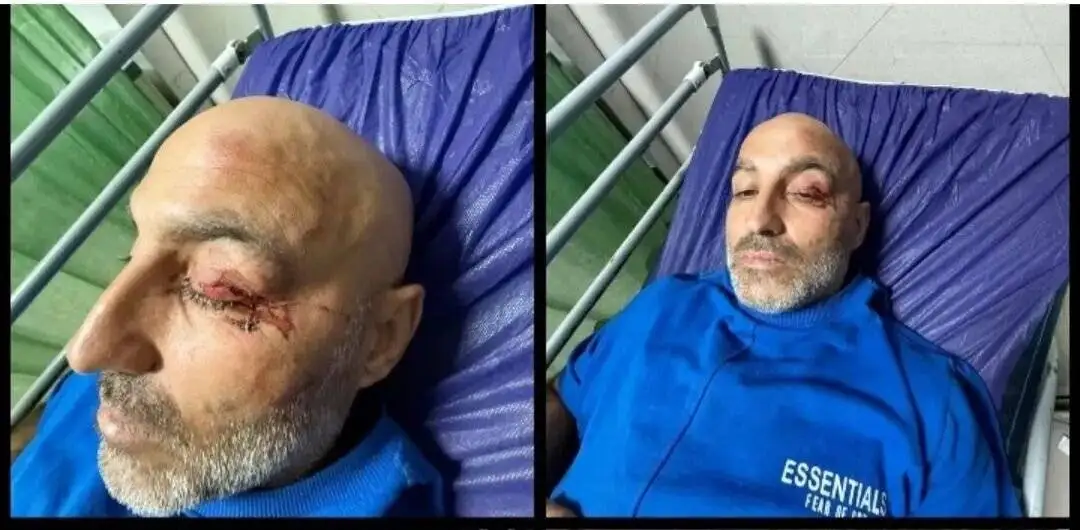 تصادف شدید در جاده شمال؛ کاپیتان سابق استقلال در بیمارستان بستری شد +عکس