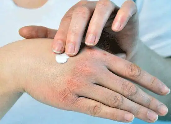با خشکی پوست در پاییز چه کنیم؟؛ 6 راه حل خانگی برای نرمی و لطافت پوست