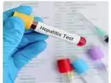 چرا بعضی ها هپاتیت می گیرند؟  -  آماری از مرگ ایرانی ها به علت هپاتیت های ویروسی