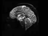 واضح ترین تصویرها از مغز با قوی ترین دستگاه ام آرآی