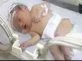 قطع نخاع نوزاد 5 ماهه گلستانی بر اثر شکستن قلنج!  -  خود درمانی های جاهلانه همچنان قربانی می گیرد!