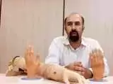 ایرانی  کاردرستی که برای خودش انگشت و دست مصنوعی ساخت