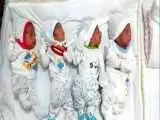 تولد نوزادان 4 قلو در کاشان  -  همه شوکه شدند