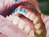 ویدیو  -  شوکه شدن دندان پزشک از اقدام جالب یک مرد برای جلوگیری از افتادن دندان هایش