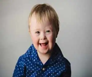 ویدیو  -  ثبت لحظه شادی وصف ناپذیر کودک مبتلا به سندرم داون به خاطر دیدن دوست صمیمی اش