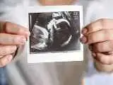 کاهش تولد در اسفند به علت جنگ 12روزه - سیاست های تشویقی جمعیت موفق نبوده؛ خانواده  باید 10 تا داروخانه بچرخد تا شیرخشک پیدا کند،تازه اگر پول داشته باشد