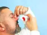 چرا خون دماغ می شویم؟ -  متداول ترین علل خونریزی بینی