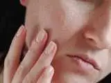11 روش مؤثر برای از بین بردن جای جوش