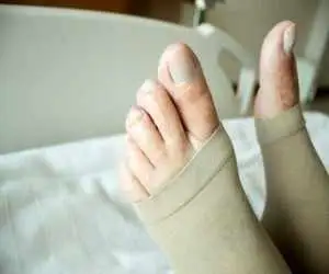 علائم هشداردهنده لخته  شدن خون در پا را بشناسید