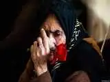 این زنان بیشتر آلزایمر می گیرند