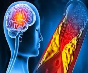 این لبخند بوی سکته می دهد