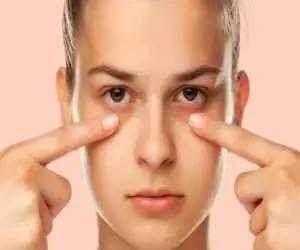 راز چشم های شاداب؛ چند راه حل  فوری برای رفع پف زیر چشم
