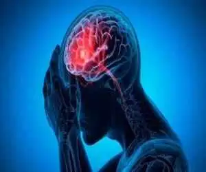 ارتباط میگرن با یک عارضه خطرناک در بینسالی