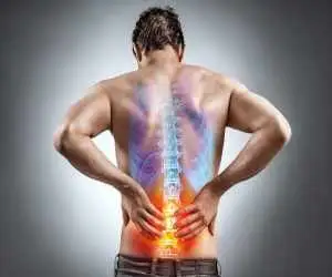چطور در خانه دیسک کمر را تشخیص دهیم؟؛ 5 تست ساده برای بررسی اولیه