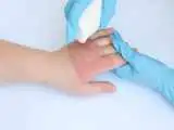 زندگی عادی برای کودکان خاص  -  افتتاح اولین درمانگاه فوق تخصصی جراحی ترمیمی کودکان؛ از شکاف لب تا سوختگی و بدشکلی