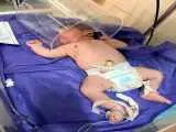 تصویر تولد کم سابقه پسر 5کیلو و 650 گرمی در کرمانشاه