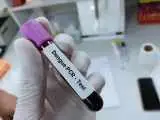 عبور آمار مبتلایان به بیماری خطرناک از 1000 نفر  -   آلودگی این منطقه در ایران به بیماری