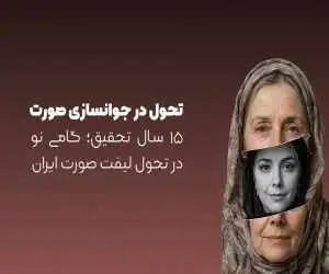 توسعه یک تکنیک نوین لیفت صورت در ایران پس از 15 سال تحقیق و بررسی تخصصی