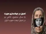 توسعه یک تکنیک نوین لیفت صورت در ایران پس از 15 سال تحقیق و بررسی تخصصی