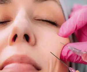 فاجعه ای که تزریق فیلر آفرید  -  بازداشت 2 برادر با لباس پزشک