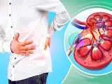 این نوشیدنی را برای فرار از سنگ کلیه نخورید!  -  ماءالشعیر دشمن سنگ کلیه است یا دوست آن؟