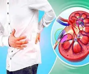 این نوشیدنی را برای فرار از سنگ کلیه نخورید!  -  ماءالشعیر دشمن سنگ کلیه است یا دوست آن؟