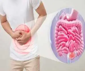 این رژیم غذایی ضد یبوست است