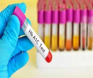 این عدد مهم در آزمایش خون، قند 3 ماه گذشته تان را لو می دهد  -  hba1c چیست و چرا بالا می رود؟