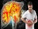 بالاخره با کبد چرب تخم مرغ بخوریم یا نه؟
