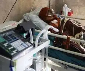مرگ مشکوک مرد جوان روی تخت بخش سوختگی بیمارستان