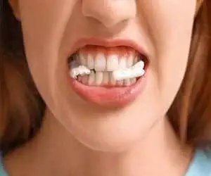 فواید شگفت انگیز جویدن آدامس که نمی دانستید؛ چه نوع آدامسی سالم تر است؟