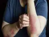 چرا داروهای بیماران نادر در کشور تولید نمی شوند؟  -  ایران سی امین کشور دارای برنامه برای حمایت از بیماران نادر